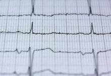 quantum pulse initiates meaningful change