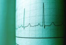 stellar pulse start driving strategic excellence