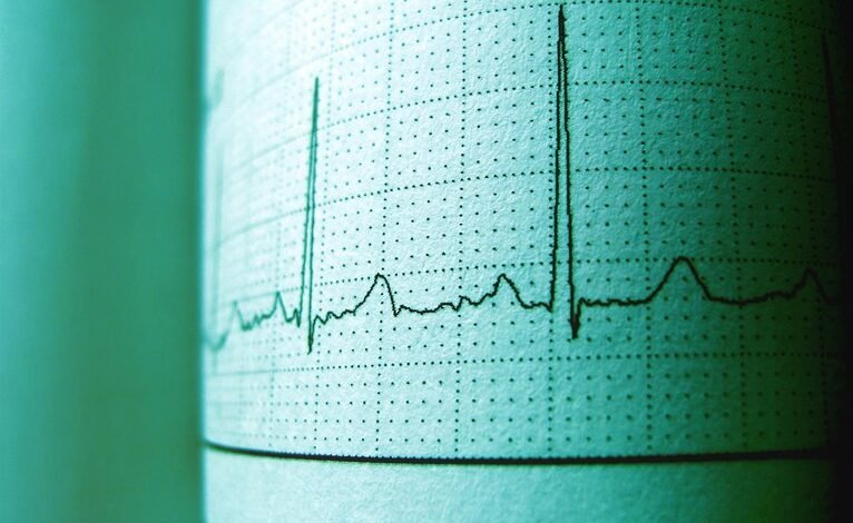 stellar pulse start driving strategic excellence