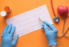 heart convection revealing procedure searches