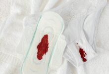 medical condition research guide hypermenorrhea